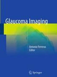 Glaucoma Imaging