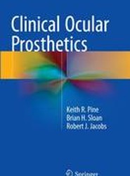 Clinical Ocular Prosthetics