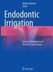Endodontic Irrigation