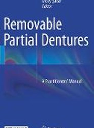 Removable Partial Dentures