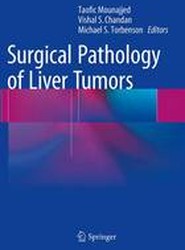 Surgical Pathology of Liver Tumors