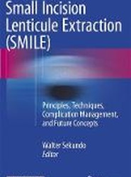 Small Incision Lenticule Extraction (SMILE)