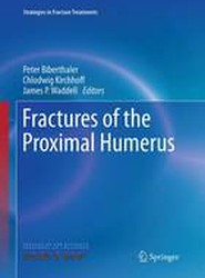 Fractures of the Proximal Humerus
