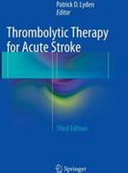 Thrombolytic Therapy for Acute Stroke