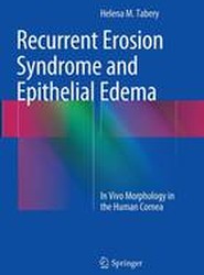 Recurrent Erosion Syndrome and Epithelial Edema