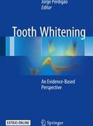 Tooth Whitening