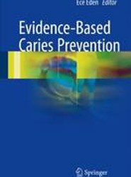 Evidence-Based Caries Prevention