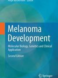 Melanoma Development
