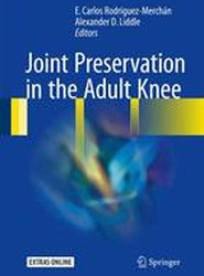 Joint Preservation in the Adult Knee