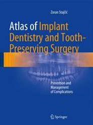 Atlas of Implant Dentistry and Tooth-Preserving Surgery