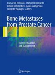 Bone Metastases from Prostate Cancer