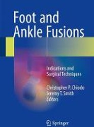 Foot and Ankle Fusions