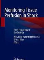 Monitoring Tissue Perfusion in Shock