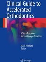 Clinical Guide to Accelerated Orthodontics