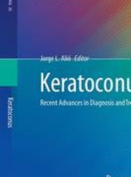 Keratoconus