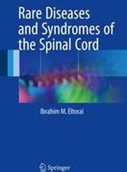 Rare Diseases and Syndromes of the Spinal Cord