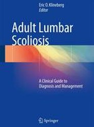 Adult Lumbar Scoliosis