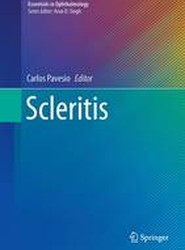 Scleritis