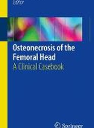 Osteonecrosis of the Femoral Head
