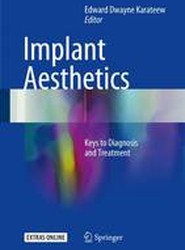 Implant Aesthetics