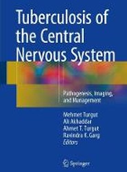 Tuberculosis of the Central Nervous System