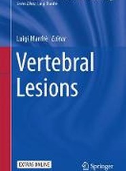 Vertebral Lesions