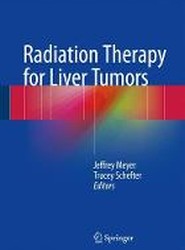 Radiation Therapy for Liver Tumors