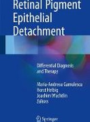 Retinal Pigment Epithelial Detachment