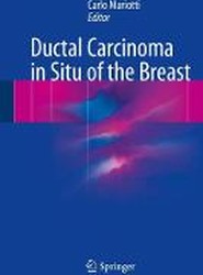 Ductal Carcinoma in Situ of the Breast