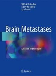 Brain Metastases