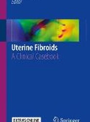 Uterine Fibroids