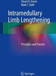Intramedullary Limb Lengthening