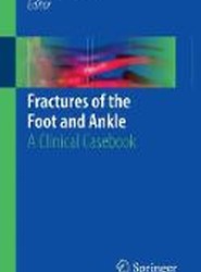 Fractures of the Foot and Ankle