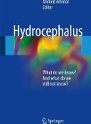 Hydrocephalus