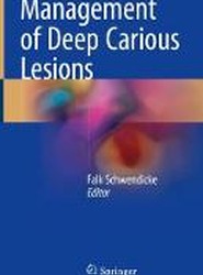 Management of Deep Carious Lesions
