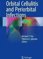 Orbital Cellulitis and Periorbital Infections