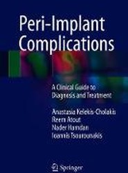 Peri-Implant Complications