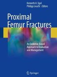 Proximal Femur Fractures