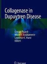 Collagenase in Dupuytren Disease