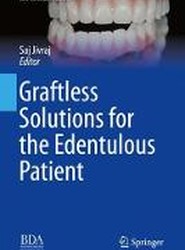 Graftless Solutions for the Edentulous Patient