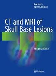 CT and MRI of Skull Base Lesions