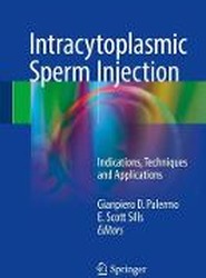 Intracytoplasmic Sperm Injection