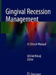 Gingival Recession Management