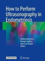 How to Perform Ultrasonography in Endometriosis