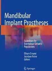 Mandibular Implant Prostheses