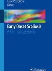 Early Onset Scoliosis