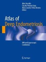 Atlas of Deep Endometriosis