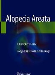 Alopecia Areata