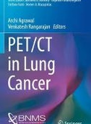 PET/CT in Lung Cancer