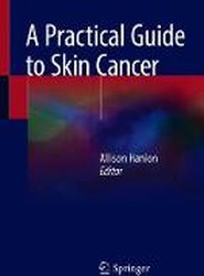 A Practical Guide to Skin Cancer